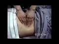 abdomenmassage